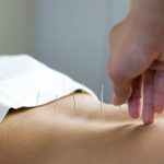 The Different Health Issues That Can Be Cured by Acupuncture